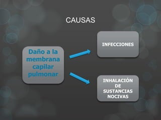 CAUSAS
Daño a la
membrana
capilar
pulmonar
INFECCIONES
INHALACIÓN
DE
SUSTANCIAS
NOCIVAS
 