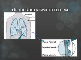 LÍQUIDOS DE LA CAVIDAD PLEURAL
 