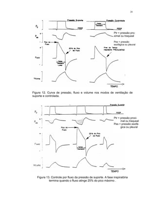 20
Figura 12. Curva de pressão, fluxo e volume nos modos de ventilação de
suporte e controlada.
Figura 13. Controle por fluxo da pressão de suporte. A fase inspiratória
termina quando o fluxo atinge 25% do pico máximo .
Ptr = pressão proxi-
mal ou traqueal
Pes = pressão esofá-
gica ou pleural
Ptr = pressão pro-
ximal ou traqueal
Pes = pressão
esofágica ou pleural
 