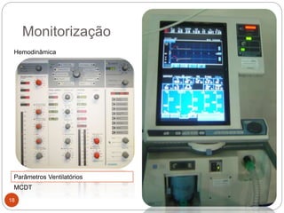 18
Monitorização
Hemodinâmica
Parâmetros Ventilatórios
MCDT
 