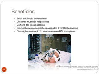  Evitar entubação endotraqueal
 Descanso músculos respiratórios
 Melhoria das trocas gasosas
 Diminuição das complicações associadas à ventilação invasiva
 Diminuição da duração do internamento na UCI e hospitalar
International Consensus Conference in Intensive Care Medicine: Non Invasiv
positive pressure ventilation in acute respiratory failure
Intensive Care Med 2001; 27; 166-178
Benefícios
29
 