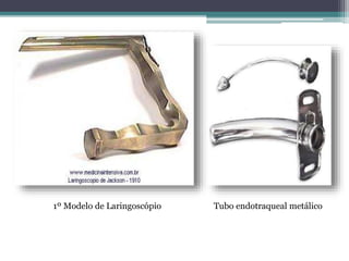 1º Modelo de Laringoscópio Tubo endotraqueal metálico
 