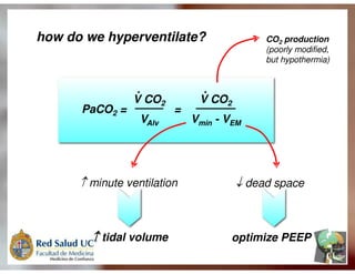 Ventilação Mecânica no TCE