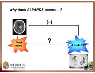 Ventilação Mecânica no TCE
