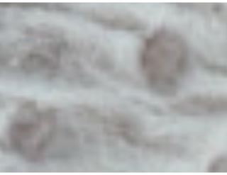 Ventilação Mecânica no TCE