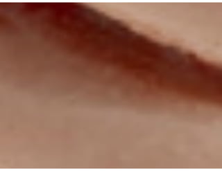 Ventilação Mecânica no TCE