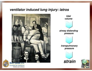 Ventilação Mecânica no TCE