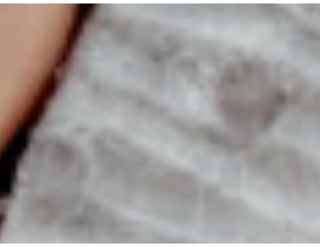 Ventilação Mecânica no TCE