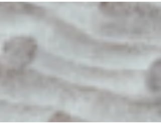 Ventilação Mecânica no TCE