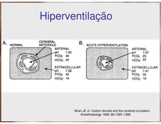 Ventilação Mecânica no TCE