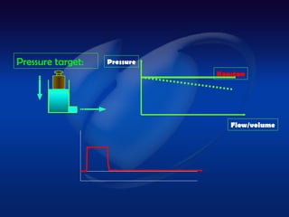 Pressure target:   Pressure
                              Konstan




                                 Flow/volume
 