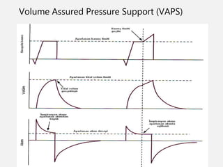 ventilasyon-mod.ppt