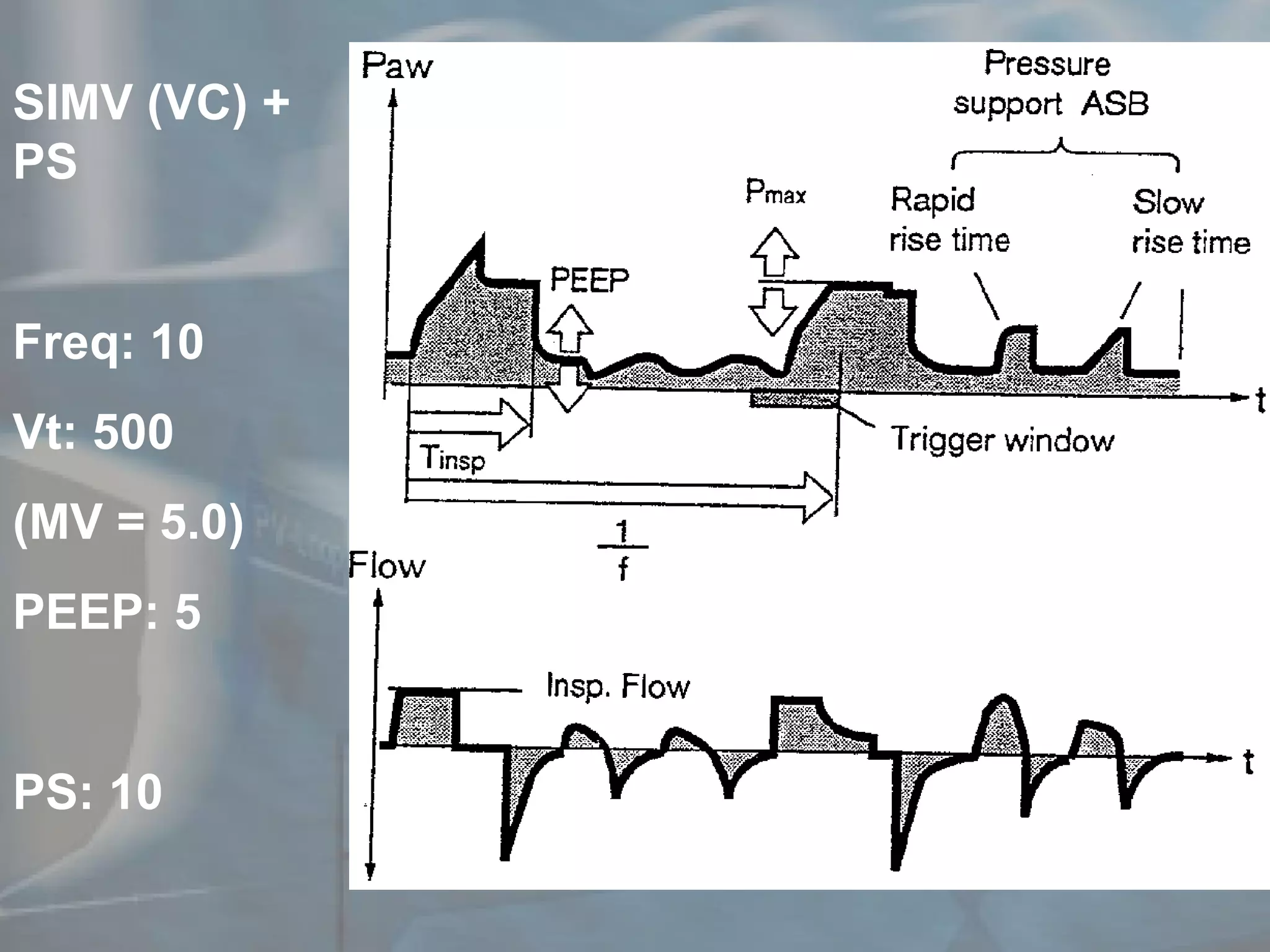 SIMV (VC) + PS Freq: 10 Vt: 500 (MV = 5.0) PEEP: 5 PS: 10 