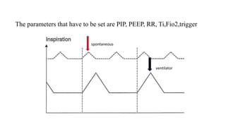The parameters that have to be set are PIP, PEEP, RR, Ti,Fio2,trigger
spontaneous
ventilator
 