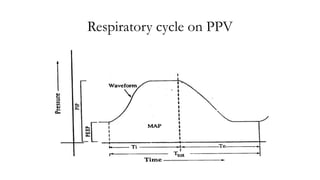 Respiratory cycle on PPV
 