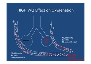 Pneumology - Ventilation perfusion-ratio-and-clinical-importance | PPT