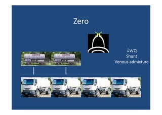 Zero

↓V/Q
Shunt
Venous admixture

 