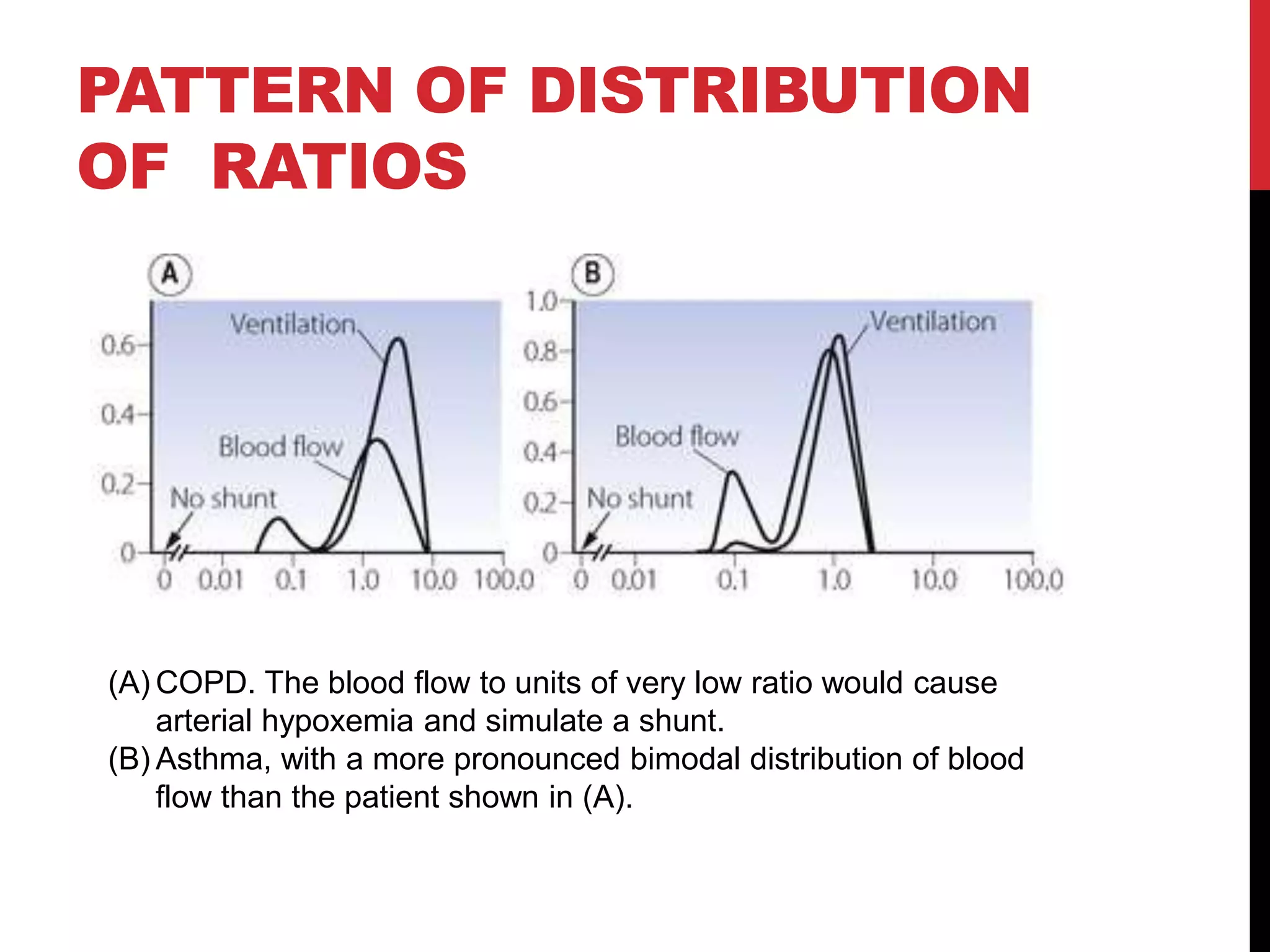 PATTERN OF DISTRIBUTION
OF RATIOS
(A) COPD. The blood flow to units of very low ratio would cause
arterial hypoxemia and simulate a shunt.
(B) Asthma, with a more pronounced bimodal distribution of blood
flow than the patient shown in (A).
 