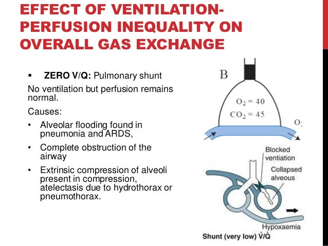 Ventilation Perfusion Relationships