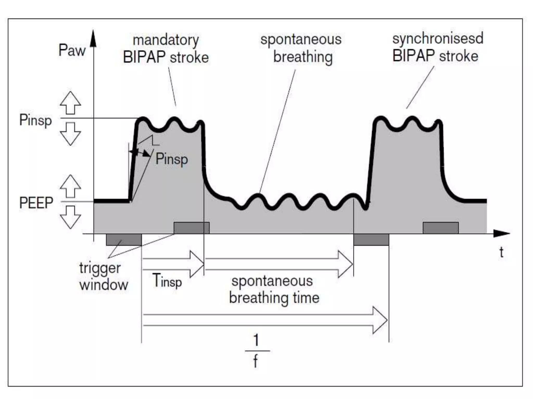 Ventilation 1 ppt