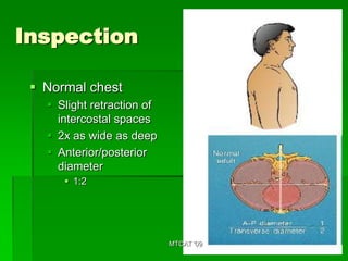 Inspection

  Normal chest
    Slight retraction of
     intercostal spaces
    2x as wide as deep
    Anterior/posterior
     diameter
       1:2




                            MTCAT '09
 