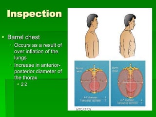 Inspection

 Barrel chest
   Occurs as a result of
    over inflation of the
    lungs
   Increase in anterior-
    posterior diameter of
    the thorax
      2:2




                            MTCAT '09
 