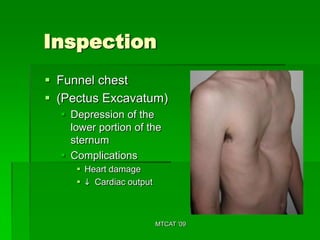 Inspection
 Funnel chest
 (Pectus Excavatum)
   Depression of the
    lower portion of the
    sternum
   Complications
      Heart damage
      i Cardiac output



                          MTCAT '09
 