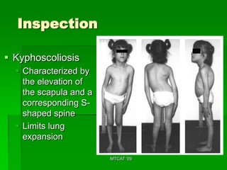 Inspection

 Kyphoscoliosis
   Characterized by
    the elevation of
    the scapula and a
    corresponding S-
    shaped spine
   Limits lung
    expansion

                        MTCAT '09
 