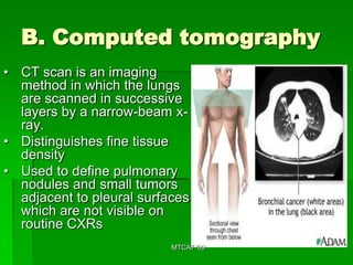B. Computed tomography
• CT scan is an imaging
  method in which the lungs
  are scanned in successive
  layers by a narrow-beam x-
  ray.
• Distinguishes fine tissue
  density
• Used to define pulmonary
  nodules and small tumors
  adjacent to pleural surfaces
  which are not visible on
  routine CXRs
                           MTCAT '09
 