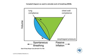 Campbell diagram as used to calculate work of breathing (WOB).
Dean R Hess Respir Care 2014;59:1773-1794
(c) 2012 by Daedalus Enterprises, Inc.
 