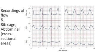 Recordings of
flow
&
Rib cage,
Abdominal
(cross-
sectional
areas)
 