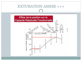 EXTUBATION ASSISE +++
 