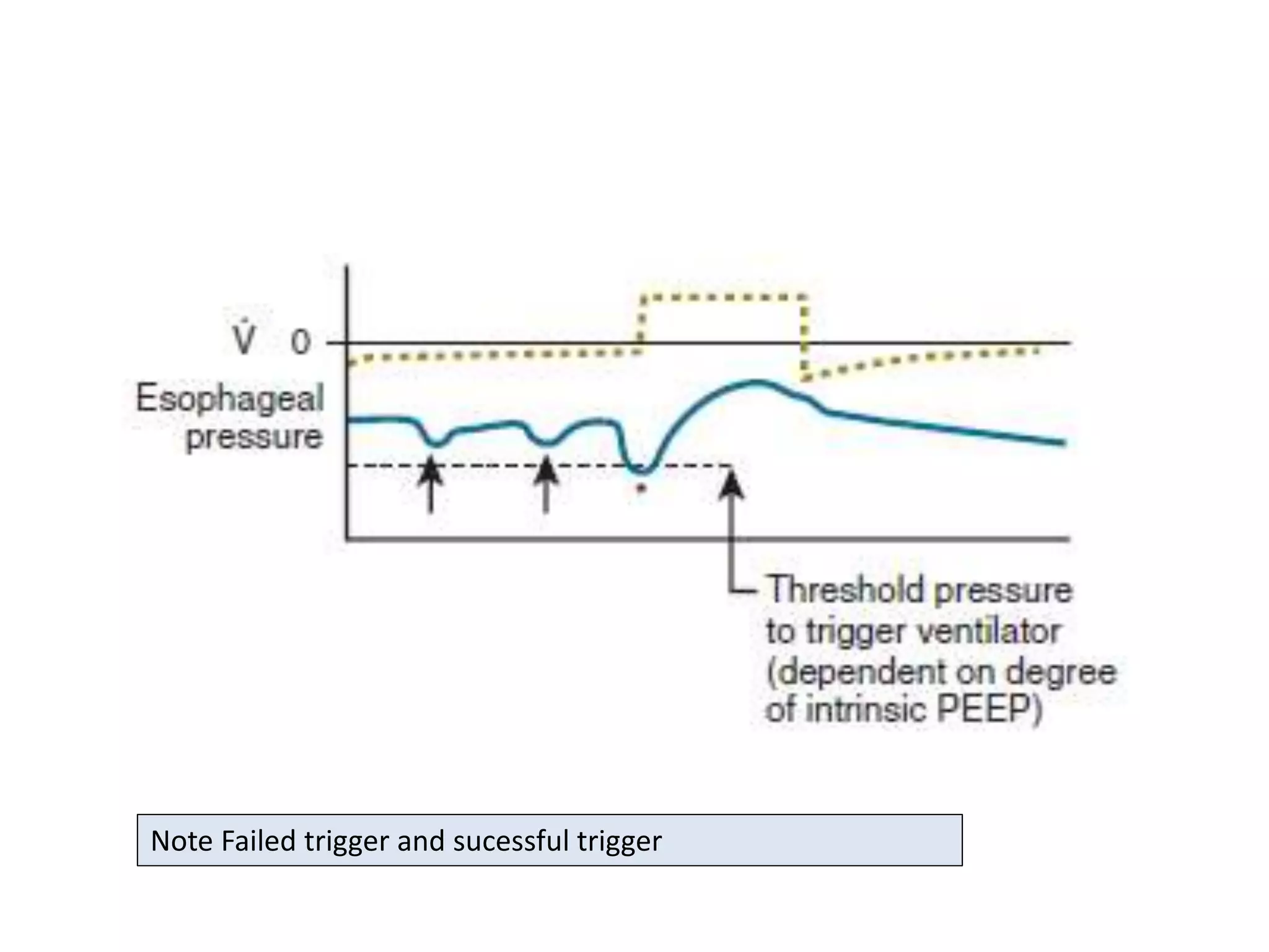 Note Failed trigger and sucessful trigger
 