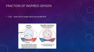 ventilation in Restrictive lung disease.pptx