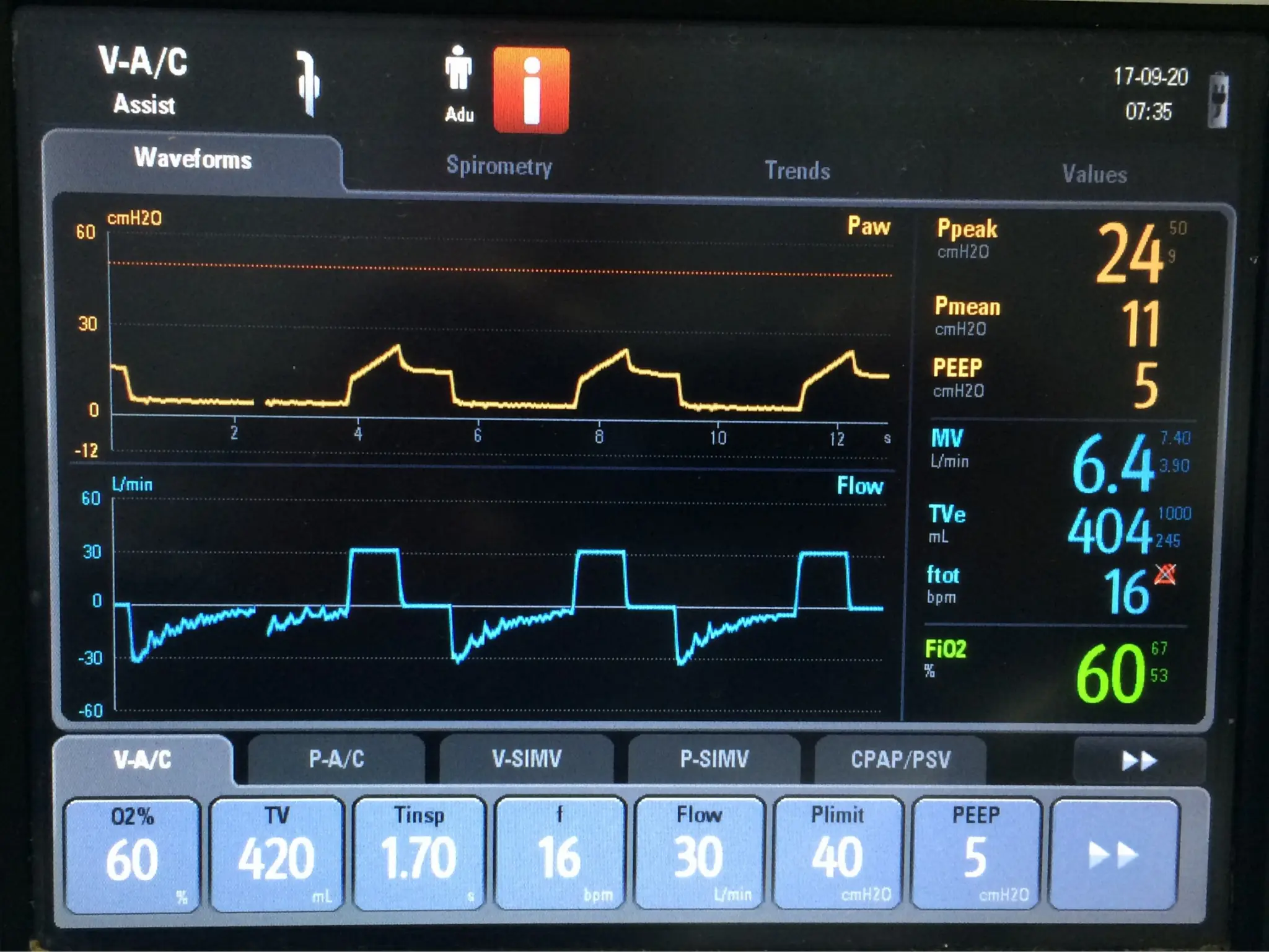 Mechanical Ventilation modes used in critical care | PPT