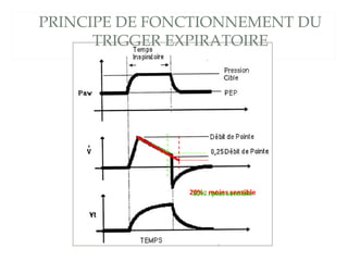 PRINCIPE DE FONCTIONNEMENT DU
TRIGGER EXPIRATOIRE
30% : plus sensible20% : moins sensible
 
