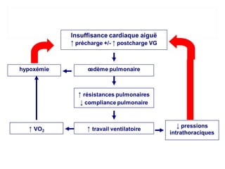 Ventilation non invasive
