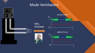 Ventilation non invasive (VNI) PNM 2023 | PDF