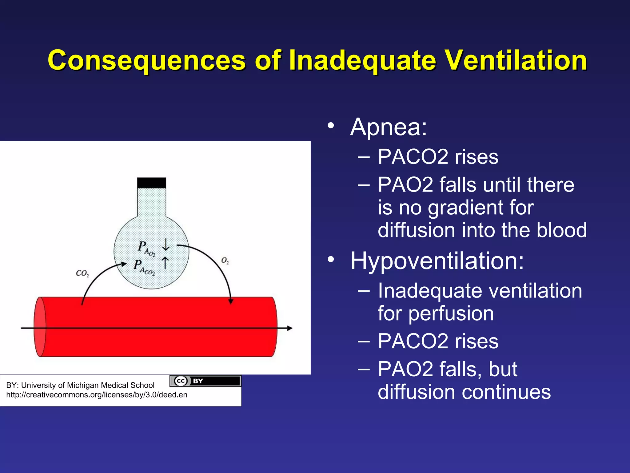 Ventilation Perfusion Matching | PPT
