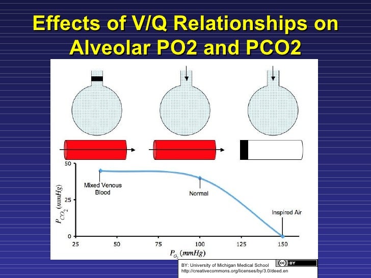 Ventilation Perfusion Matching
