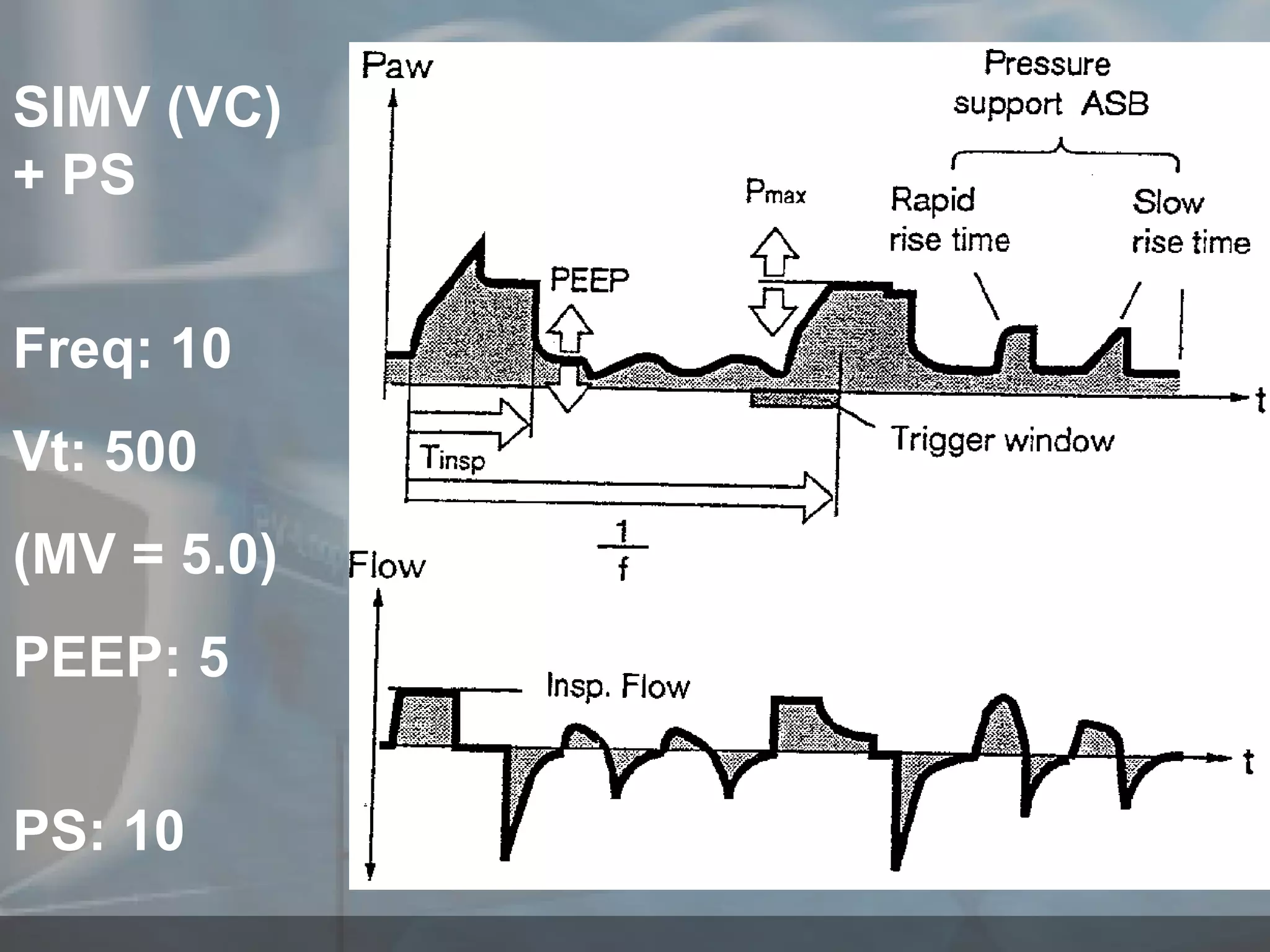 SIMV (VC) + PS Freq: 10 Vt: 500 (MV = 5.0) PEEP: 5 PS: 10 
