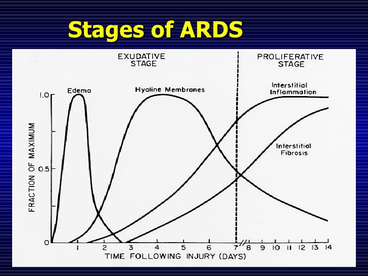 Ventilation strategies in ards rachmale