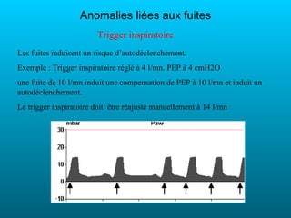 Anomalies liées aux fuites
                        Trigger inspiratoire
Les fuites induisent un risque d’autodéclenchement.
Exemple : Trigger inspiratoire réglé à 4 l/mn. PEP à 4 cmH2O
une fuite de 10 l/mn induit une compensation de PEP à 10 l/mn et induit un
autodéclenchement.
Le trigger inspiratoire doit être réajusté manuellement à 14 l/mn
 