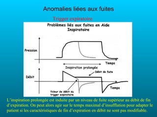 Anomalies liées aux fuites
                          Trigger expiratoire




L’inspiration prolongée est induite par un niveau de fuite supérieur au débit de fin
d’expiration. On peut alors agir sur le temps maximal d’insufflation pour adapter le
patient si les caractéristiques de fin d’expiration en débit ne sont pas modifiable.
 
