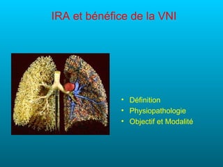 IRA et bénéfice de la VNI




             • Définition
             • Physiopathologie
             • Objectif et Modalité
 