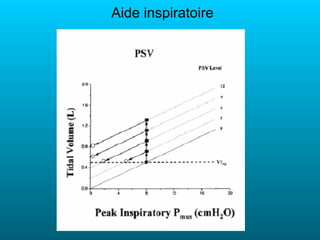 Aide inspiratoire
 