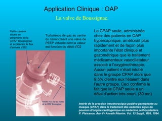 Application Clinique : OAP
                               La valve de Boussignac.

Petits canaux                                             La CPAP seule, administrée
situés en
périphérie de la
                        Turbulence de gaz au centre       chez des patients en OAP
                        du canal créant une valve de
CPAP Boussignac                                           hypercapnique, améliorait plus
et accélérant le flux   PEEP virtuelle dont la valeur
d'arrivée d’O2          est fonction du débit d'O2        rapidement et de façon plus
                                                          importante l’état clinique et
                                                          gazométrique que le traitement
                                                          médicamenteux vasodilatateur
                                                          associé à l’oxygénothérapie.
                                                          Aucun patient n’était intubé
                                                          dans le groupe CPAP alors que
                                                          9,5% d’entre eux l’étaient dans
                                                          l’autre groupe. Ceci confirme le
                                                          fait que la CPAP seule a un
                                                          délai d’action très court. (30 mn)

                                               Intérêt de la pression intrathoracique positive permanente au
                                               masque (CPAP) dans le traitement des oedèmes aigus du
                                               poumon d'origine cardiogénique en médecine préhospitalière.
                                               P. Plaisance, Ann Fr Anesth Réanim. Vol. 13 Suppl., R99, 1994.
 