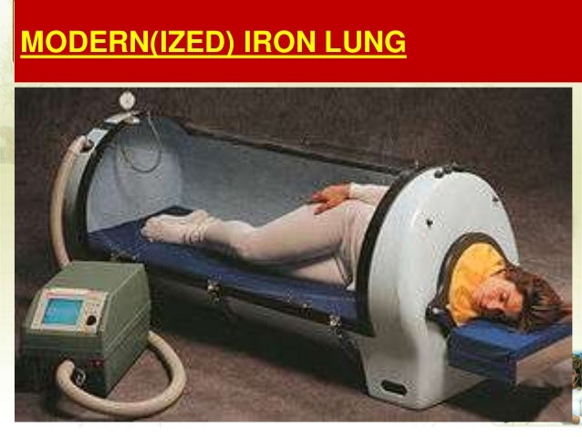 ventilators how an iron lung works