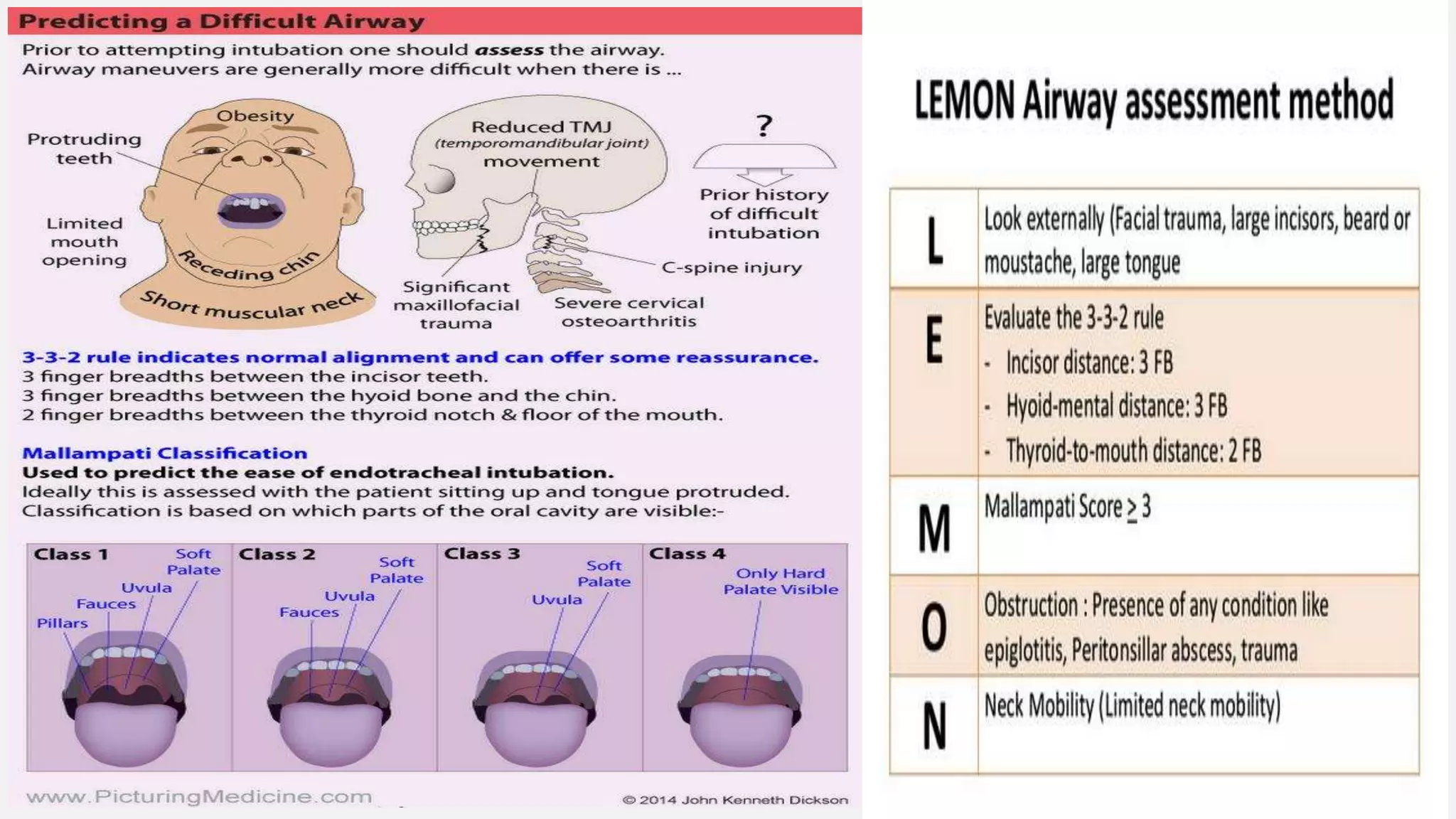 Intubation.pptx