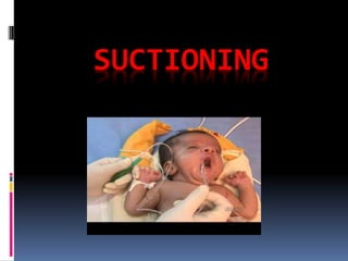 SUCTIONING
 